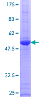 12.5% SDS-PAGE Stained with Coomassie Blue.